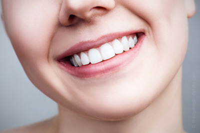 Des dents blanches naturellement avec du Charbon Actif