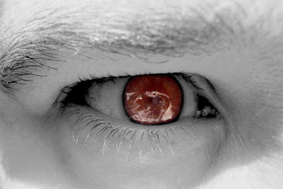 hypnose hypnose